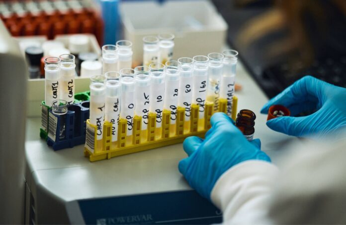 Trybe Labs, at-home lab testing facility, acquired by Hims & Hers | ROI-NJ